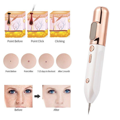 Blue Light Acne Beauty Instrument